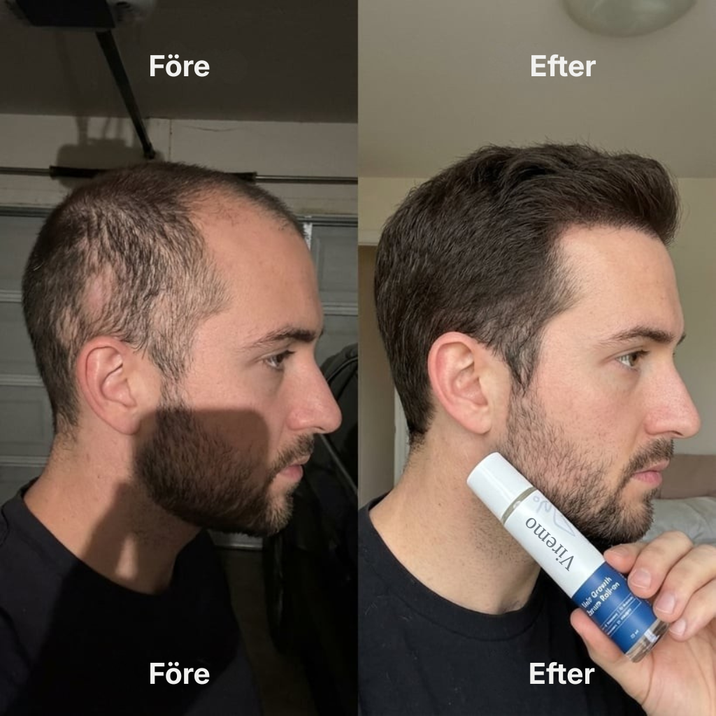 Viremo® Roll-on-serum för hårväxt