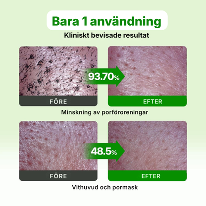 Selivo® Porengöring med grön tomat | Cardi B:s lermaskrengöring för djuprengöring av porer och porförminskning, kontroll av pormaskar och talg, mild ansiktstvätt för kvinnor, koreansk hudvård