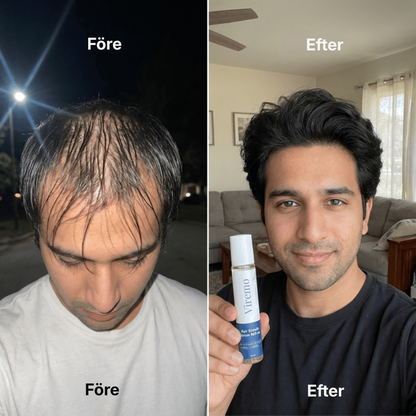 Viremo® Roll-on-serum för hårväxt