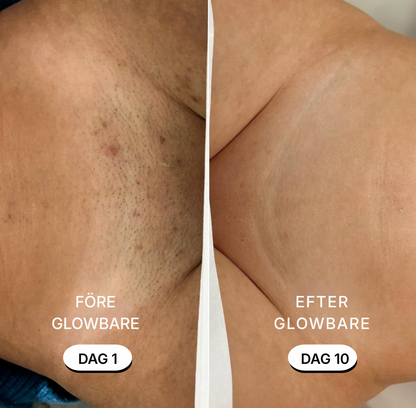 GlowBare® | 5-in-1 Razor