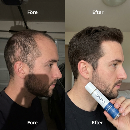 Capora® | Roll-on-serum för hårväxt