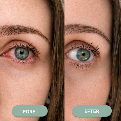 Oculiva® | Terapeutisk ångapparat – Verklig lindring vid torrhet, sveda, irritation, ögoninflammation och svullnader under ögonen