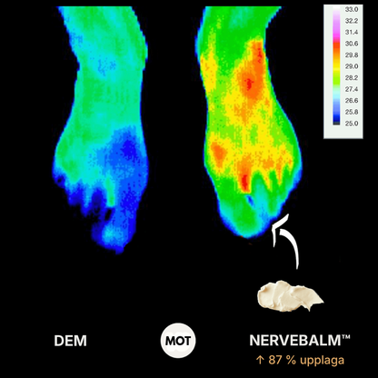 Vioren® Nervbalsam | Avancerad kräm för nervvård