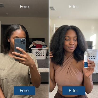 Capora® | Roll-on-serum för hårväxt
