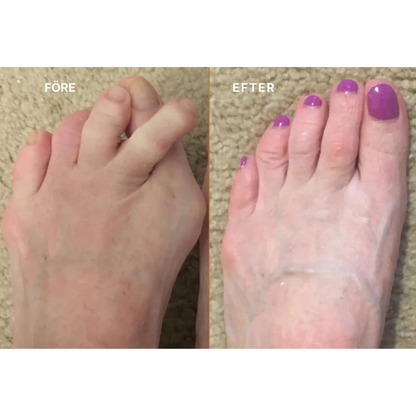 Aligna® | Tåkorrigerare