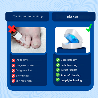 BlåKur | Smärtfri och effektiv behandling av svamp och kritaktiga naglar