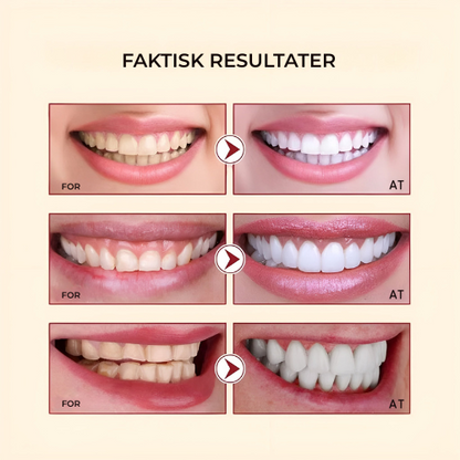 BrightSmile® | kraften bakom ett strålande leende