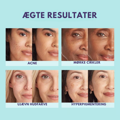 Supreme Crème® | Allt-i-ett glöd för ansikte och kropp på 90 sekunder, håller perfekt i 12 timmar