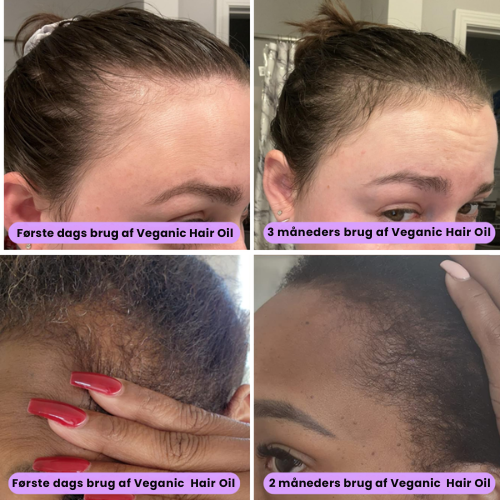Veganic® | 100% Naturlig Hårväxtolja