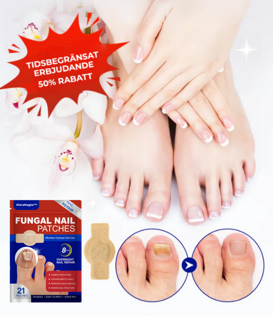 KlaraNaglar™ | Slip af med neglesvamp for altid – se resultater på kun 2 uger!